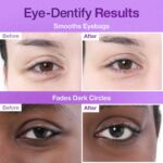 پچ زیر چشم NAD و کلاژن نامبوزین - Image 4