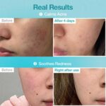 ماسک B5 و هیالورونیک اسید ضد التهاب و تسکین دهنده نامبوزین - Image 6