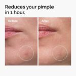 کنسانتره پودر به کرم گوگرد ۱۰٪ اوردینری کانادا - Image 4