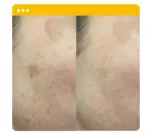 آمپول روشن کننده و ضد لک مدیتراپی Vita Real Toning Shot - Image 3